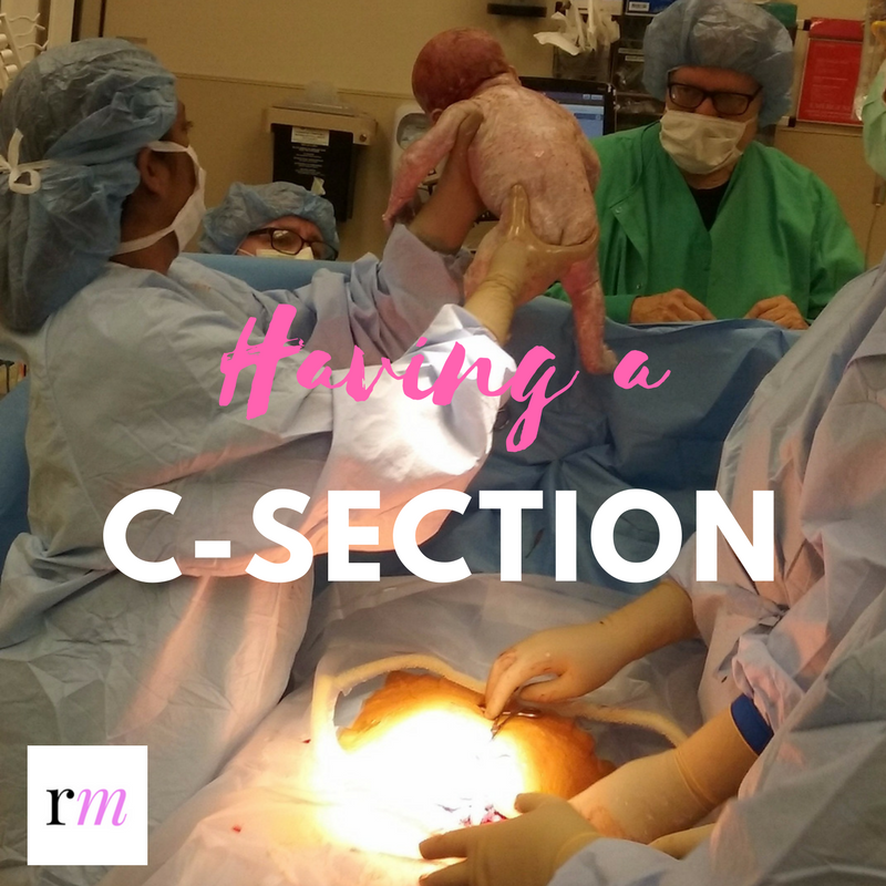 Having a c-section